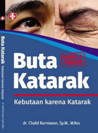 Image of Buta Katarak : Kebutaan Karena Katarak