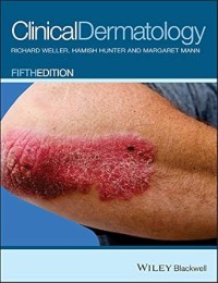 Image of Clinical Dermatology (Fifth Edition)