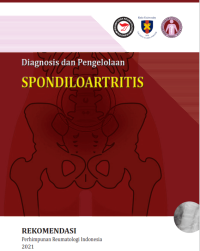 Image of Diagnosis dan Pengelolaan Spondiloartritis
