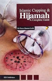 Image of Islamic Cupping & Hijamah: A Complete Guide