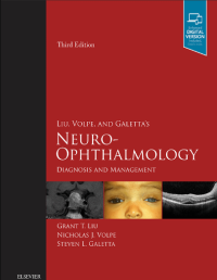 Image of Neuro- Ophthlmmology : Diagnosis Management