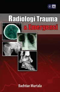 Image of Radiologi Trauma & Emergensi